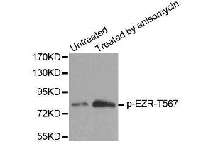 Western blot analysis of extracts from MDA cells, using Phospho-EZR-T567 antibody (ABIN2987611). (Ezrin antibody  (pThr567))