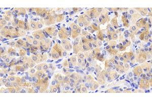Detection of mTOR in Human Stomach Tissue using Monoclonal Antibody to Serine/threonine-protein kinase mTOR (mTOR) (MTOR antibody  (AA 2226-2488))