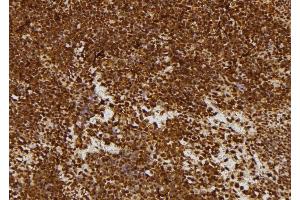 ABIN6277693 at 1/100 staining Mouse spleen tissue by IHC-P. (MECOM antibody  (C-Term))