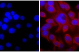 Human pancreatic carcinoma cell line MIA PaCa-2 was stained with Mouse Anti-Cytokeratin 18-UNLB and DAPI. (Goat anti-Mouse IgG (Heavy & Light Chain) Antibody (TRITC) - Preadsorbed)