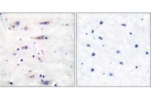Immunohistochemistry analysis of paraffin-embedded human brain tissue, using NMDAR1 (Ab-897) Antibody. (GRIN1/NMDAR1 antibody  (AA 864-913))