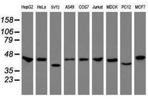 Image no. 3 for anti-Chromobox Homolog 8 (CBX8) (AA 1-260) antibody (ABIN1490659) (CBX8 antibody  (AA 1-260))