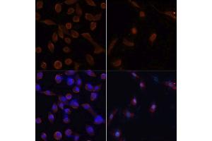 Immunofluorescence analysis of NIH/3T3 cells using MAP1LC3B antibody. (LC3B antibody)