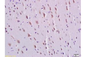 Formalin-fixed and paraffin embedded rat brain labeled with Rabbit Anti-PDGFBB Polyclonal Antibody, Unconjugated  at 1:200 followed by conjugation to the secondary antibody and DAB staining, (PDGF-BB Homodimer (AA 151-241) antibody)