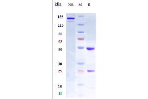 Anti-LIF Reference Antibody (MSC-1) on SDS-PAGE under reducing (R) condition. (Recombinant LIF antibody)