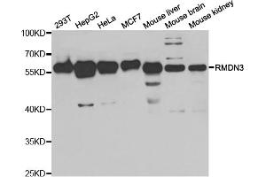 Western blot analysis of extracts of various cell lines, using RMDN3 antibody (ABIN5973434) at 1/1000 dilution. (RMDN3 antibody)