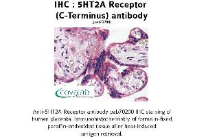 Image no. 2 for anti-5-Hydroxytryptamine (serotonin) Receptor 2A (HTR2A) (C-Term) antibody (ABIN1731361) (HTR2A antibody  (C-Term))