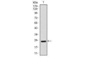 Image no. 2 for anti-Activated Leukocyte Cell Adhesion Molecule (ALCAM) antibody (ABIN1491488) (CD166 antibody)