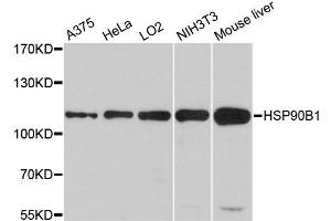 Western blot analysis of extracts of various cell lines, using HSP90B1 antibody (ABIN5970377) at 1/1000 dilution. (GRP94 antibody)