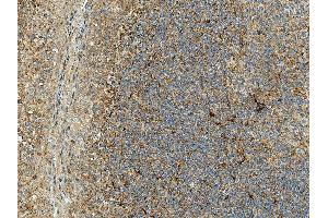 Immunohistochemistry analysis using Rabbit Anti-Rubicon Polyclonal Antibody (ABIN5066366). (Rubicon antibody  (N-Term) (HRP))