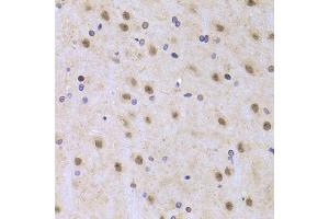 Immunohistochemistry of paraffin-embedded rat brain using ILF2 Antibody (ABIN5973487) at dilution of 1/100 (40x lens). (ILF2 antibody)