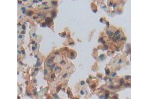 IHC-P analysis of Human Tissue, with DAB staining. (LOXL1 antibody  (AA 369-574))