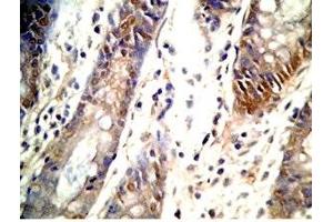 Human colon tissue was stained by Rabbit Anti-GLP-1 (2-24) (Human) Antibody (GLP-1 antibody  (AA 2-24))
