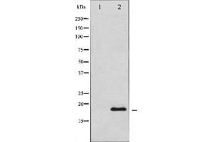 Western blot analysis of Synuclein expression in HuvEc whole cell lysates,The lane on the left is treated with the antigen-specific peptide. (SNCA antibody  (C-Term))