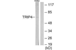 Western blot analysis of extracts from K562 cells, using TRIP4 antibody. (TRIP4 antibody  (Internal Region))