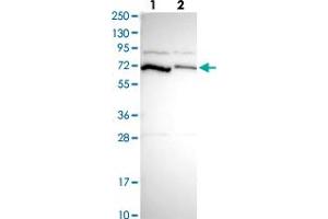 Western blot analysis of Lane 1: Human cell line RT-4 Lane 2: Human cell line U-251MG sp with PCK2 polyclonal antibody  at 1:250-1:500 dilution.