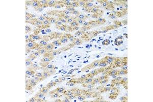 Immunohistochemistry of paraffin-embedded human liver injury using PEX14 antibody. (PEX14 antibody  (AA 118-377))