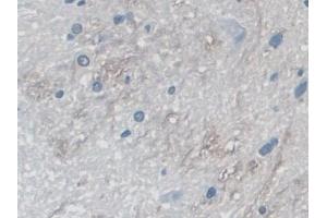 Detection of MYO1D in Rat Spinal cord Tissue using Polyclonal Antibody to Myosin ID (MYO1D)