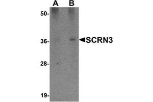 Western blot analysis of SCRN3 in 293 cell tissue lysate with SCRN3 antibody at (A) 1 and (B) 2 μg/ml. (Secernin 3 antibody  (Center))