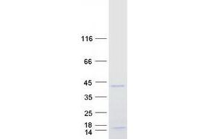 Western Blotting (WB) image for Paired Related Homeobox 1 (PRRX1) protein (Myc-DYKDDDDK Tag) (ABIN2729862)