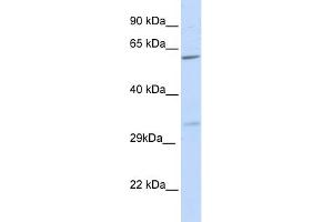 WB Suggested Anti-PRPS2 Antibody Titration:  0. (PRPS2 antibody  (N-Term))