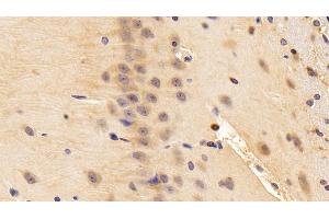 Detection of NGF in Rat Cerebrum Tissue using Polyclonal Antibody to Nerve Growth Factor (NGF) (Nerve Growth Factor antibody  (AA 19-241))