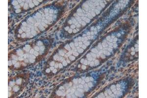DAB staining on IHC-P; Samples: Human Rectum Tissue (CRAF antibody  (AA 342-619))