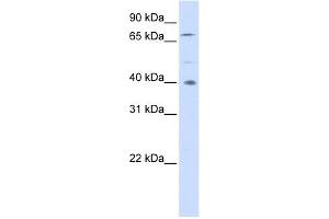 SPATA7 antibody used at 1 ug/ml to detect target protein. (SPATA7 antibody  (Middle Region))