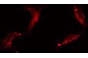 Immunofluorescence (fixed cells) (IF/ICC) image for anti-Intercellular Adhesion Molecule 1 (ICAM1) (C-Term) antibody (ABIN6262433)
