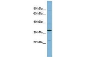 Image no. 1 for anti-SET Nuclear Oncogene (SET) (AA 35-84) antibody (ABIN6741772) (SET/TAF-I antibody  (AA 35-84))