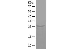 Western Blotting (WB) image for Defective in Cullin Neddylation 1, Domain Containing 1 (DCUN1D1) (AA 1-259) protein (His tag) (ABIN7122613) (DCUN1D1 Protein (AA 1-259) (His tag))