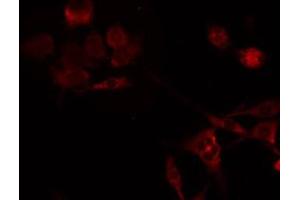 ABIN6275245 staining HeLa by IF/ICC. (MRPL49 antibody  (Internal Region))