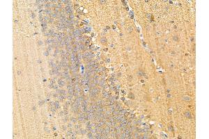 ABIN6256183 and ABIN6267191 at 1/100 staining Rat brain tissue by IHC-P. (tau antibody  (pSer199, pSer516))