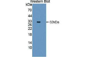 Detection of Recombinant CTNNa1, Human using Polyclonal Antibody to Catenin Alpha 1 (CTNNa1) (CTNNA1 antibody  (AA 2-228))