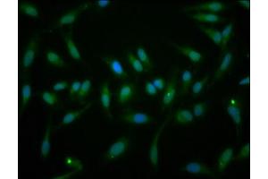 Immunofluorescence staining of Hela cells with ABIN7152355 at 1:166, counter-stained with DAPI. (EYA1 antibody  (AA 168-321))