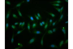 Immunofluorescence staining of Hela cells with ABIN7152355 at 1:166, counter-stained with DAPI.