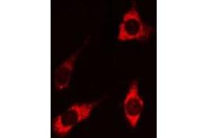 ABIN6269202 staining HEK 293 cells by IF/ICC. (PI3K p85 alpha/gamma antibody)