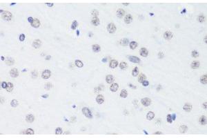 Immunohistochemistry of paraffin-embedded Rat brain using TriMethyl-Histone H3-K64 Polyclonal Antibody at dilution of 1:100 (40x lens). (Histone 3 antibody  (3meLys64))