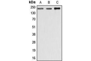 Western blot analysis of Dysferlin expression in MCF7 (A), SP2/0 (B), rat liver (C) whole cell lysates. (Dysferlin antibody  (C-Term))
