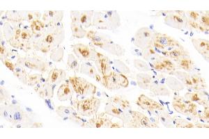 Detection of H-FABP in Human Cardiac Muscle Tissue using Polyclonal Antibody to Heart-type Fatty Acid Binding Protein (H-FABP)