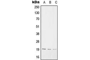 Western blot analysis of SNX3 expression in A2058 (A), Raw264. (Sorting Nexin 3 antibody  (Center))
