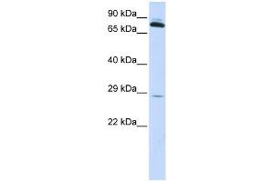TPK1 antibody used at 1 ug/ml to detect target protein. (TPK1 antibody  (N-Term))
