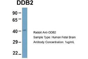 Host: Rabbit  Target Name: DDB2  Sample Tissue: Human Fetal Brain  Antibody Dilution: 1. (DDB2 antibody  (C-Term))