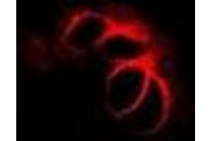 Immunofluorescent analysis of CHMP2B staining in MCF7 cells. (CHMP2B antibody)