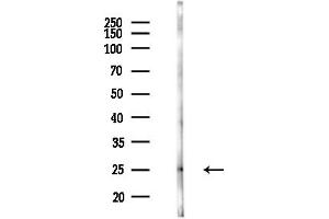 anti-Proteasome Subunit Alpha Type 3 (PSMA3) (Internal Region) antibody