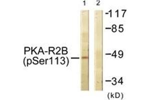 Western blot analysis of extracts from COS7 cells treated with PMA 125ng/ml 30', using PKA-R2 beta (Phospho-Ser113) Antibody. (PRKAR2B antibody  (pSer113))