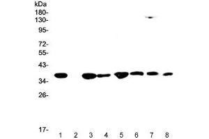 Western blot testing of human 1) HeLa, 2) placenta, 3) SW620, 4) PANC-1, 5) HepG2, 6) A549, 7) rat RH35 and 8) mouse HEPA1-6 lysate with SMN1/2 antibody at 0. (SMN1 / SMN2 antibody)
