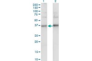 Western Blot analysis of TSPAN32 expression in transfected 293T cell line by TSPAN32 monoclonal antibody (M02), clone 2B4. (TSPAN32 antibody  (AA 194-290))
