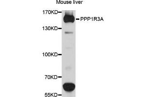 Western blot analysis of extracts of mouse liver cells, using PPP1R3A antibody. (PPP1R3A antibody)
