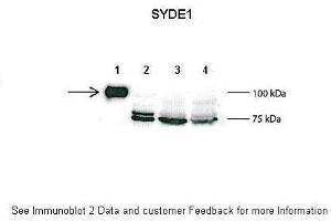 Lanes:   1: 2ug mouse SYDE1 transfected HEK293T lysate, 2: 15ug untransfected HEK293T lysate, 3: 100ug wild type mouse brain lysate, 4: 100ug SYDE1 knock-out mouse brain lysate  Primary Antibody Dilution:   1:500  Secondary Antibody:   Anti-rabbit L-chain HRP  Secondary Antibody Dilution:   1:10,000  Gene Name:   SYDE1  Submitted by:   Anonymous (SYDE1 antibody  (C-Term))